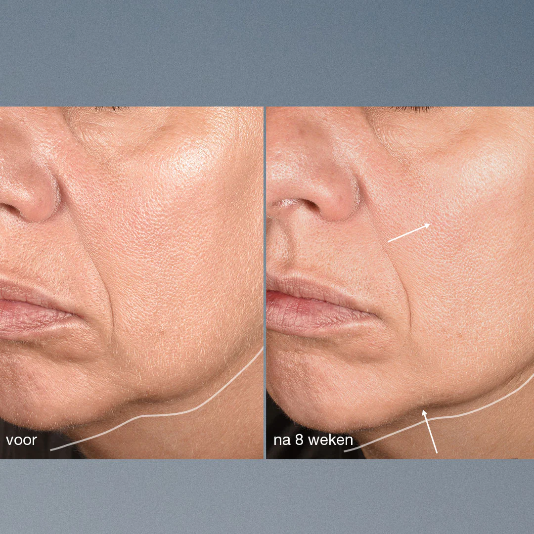 NeuroTouch Symmetry Serum - Afbeelding 2