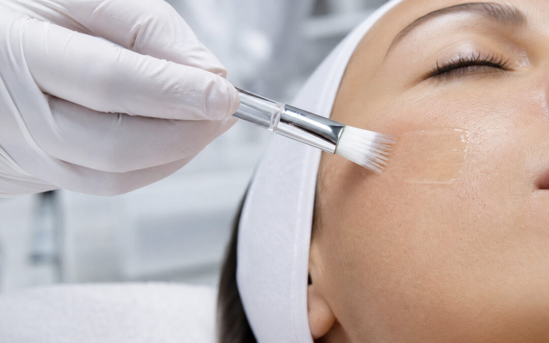 Geavanceerde Chemische Peelings in Voorschoten: LuminFusion & BioSurface