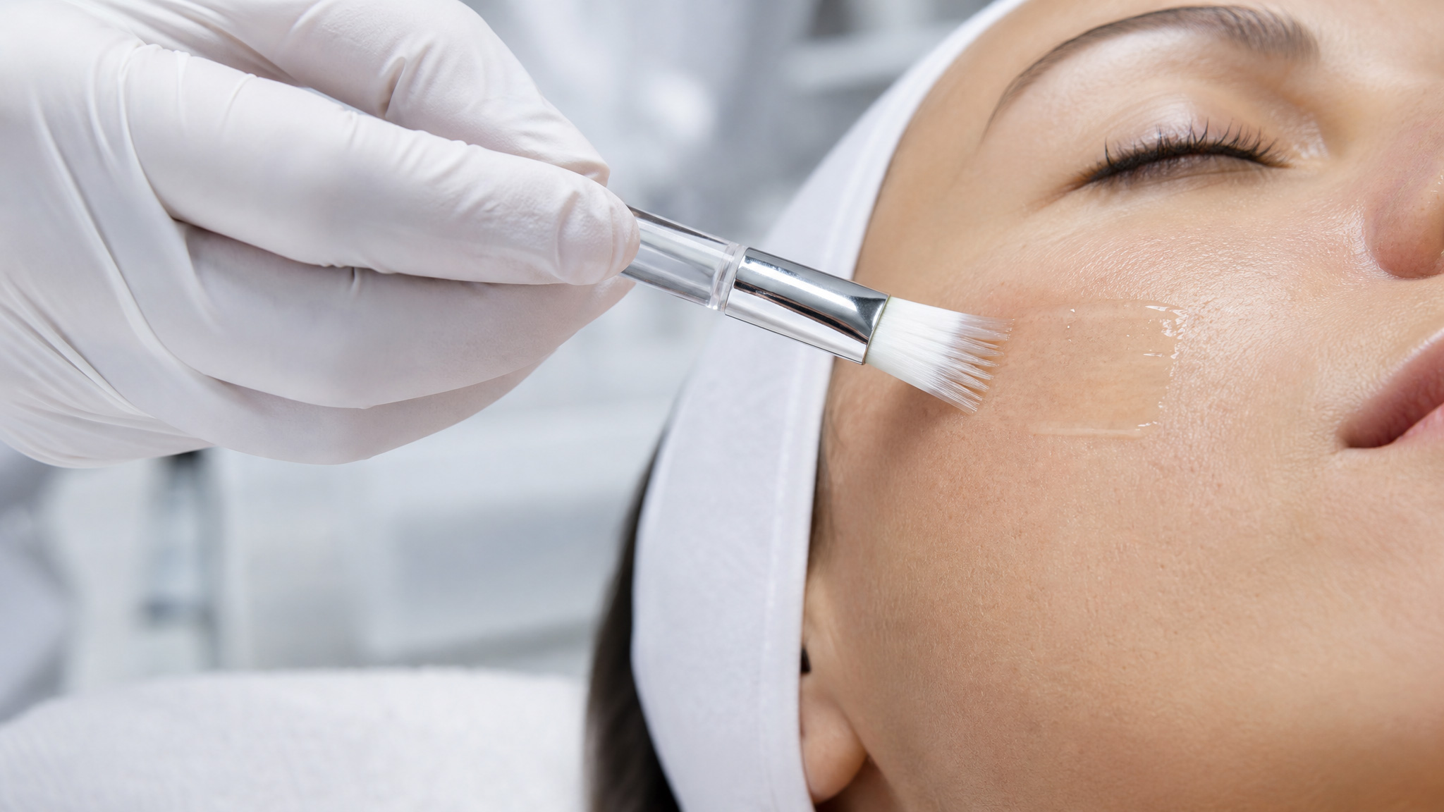 Nauwkeurige applicatie van een Dermalogica chemische peeling met penseel.